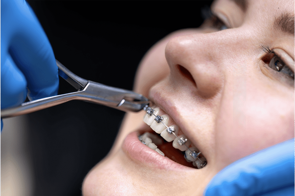 Orthodontie