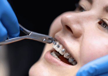 Orthodontie