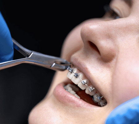Orthodontie